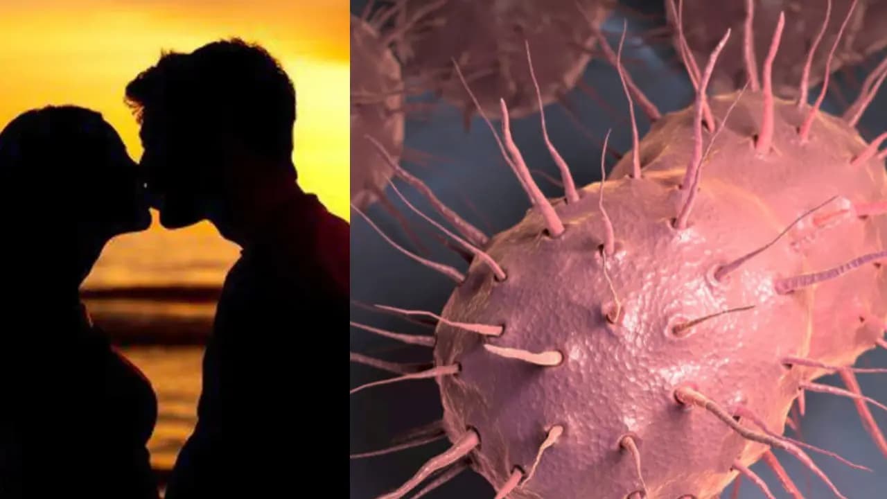  oropharyngeal gonorrhoea sexual disease