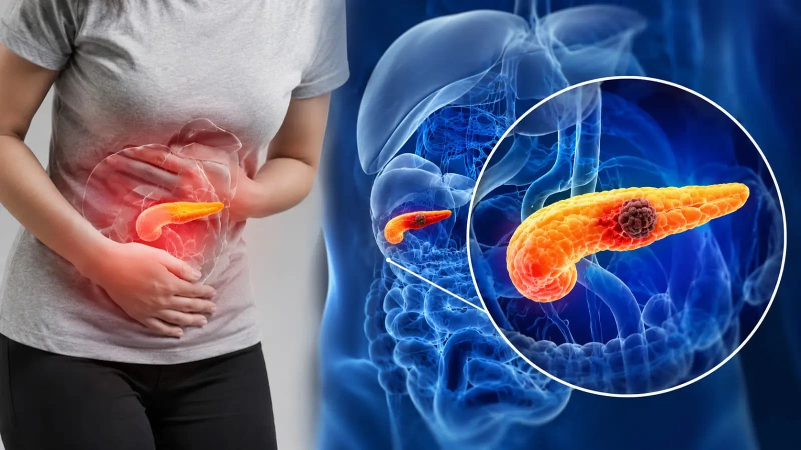 Pancreatic Cancer Warning Signs: Early Symptoms and Risk Factors to Watch