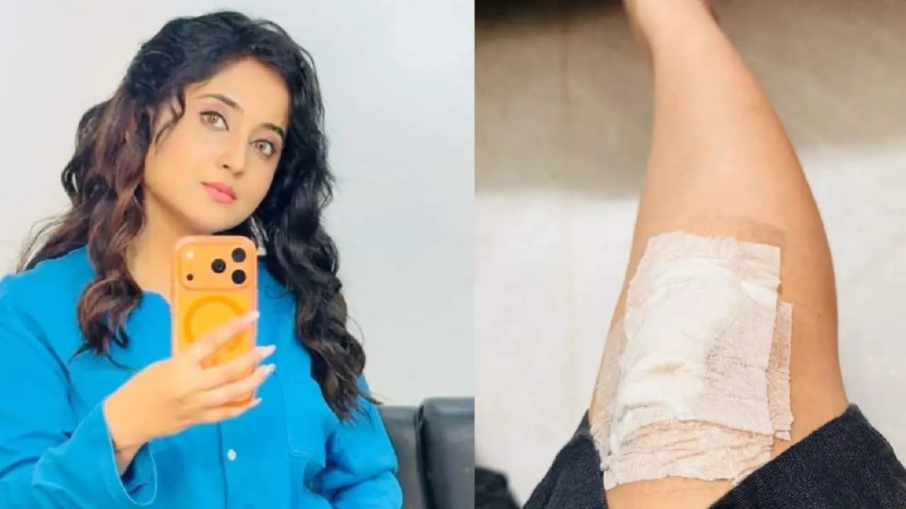 Soumitrisha Kundu got injured during shooting 