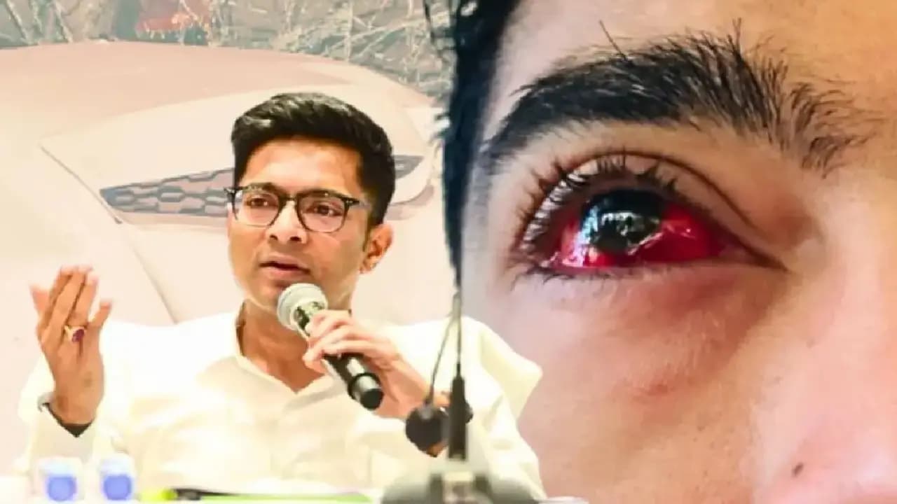 Abhishek Banerjee Eye treatment big update MP travels foreign country here know about his eye treatment reason 