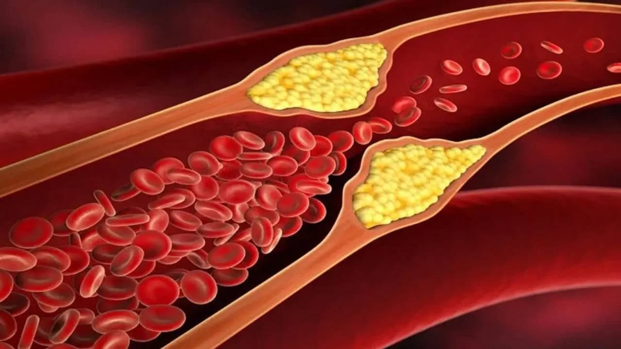 Onions for Cholesterol Control: Key Health Benefits and Nutritional Facts