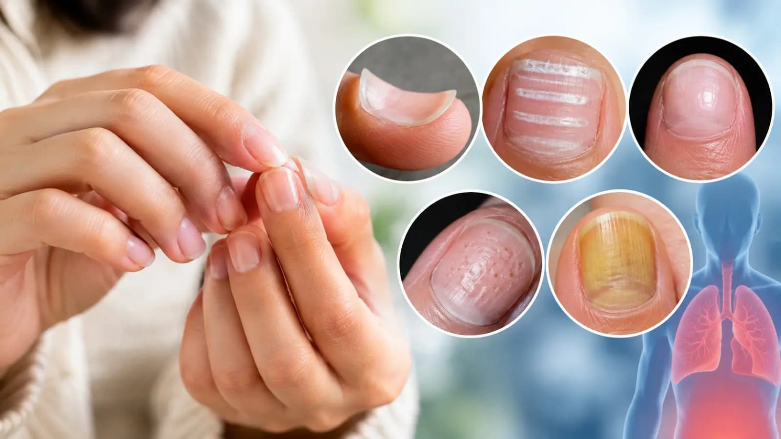 Nail Changes Health Signs What Your Nails Reveal About Your Health