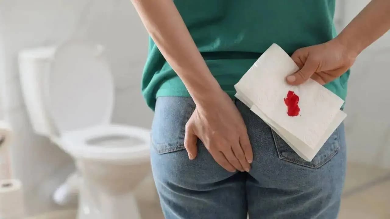 Rectal Bleeding May Not Be Piles: Doctors Explain Key Differences Between Hemorrhoids and Fissures 
