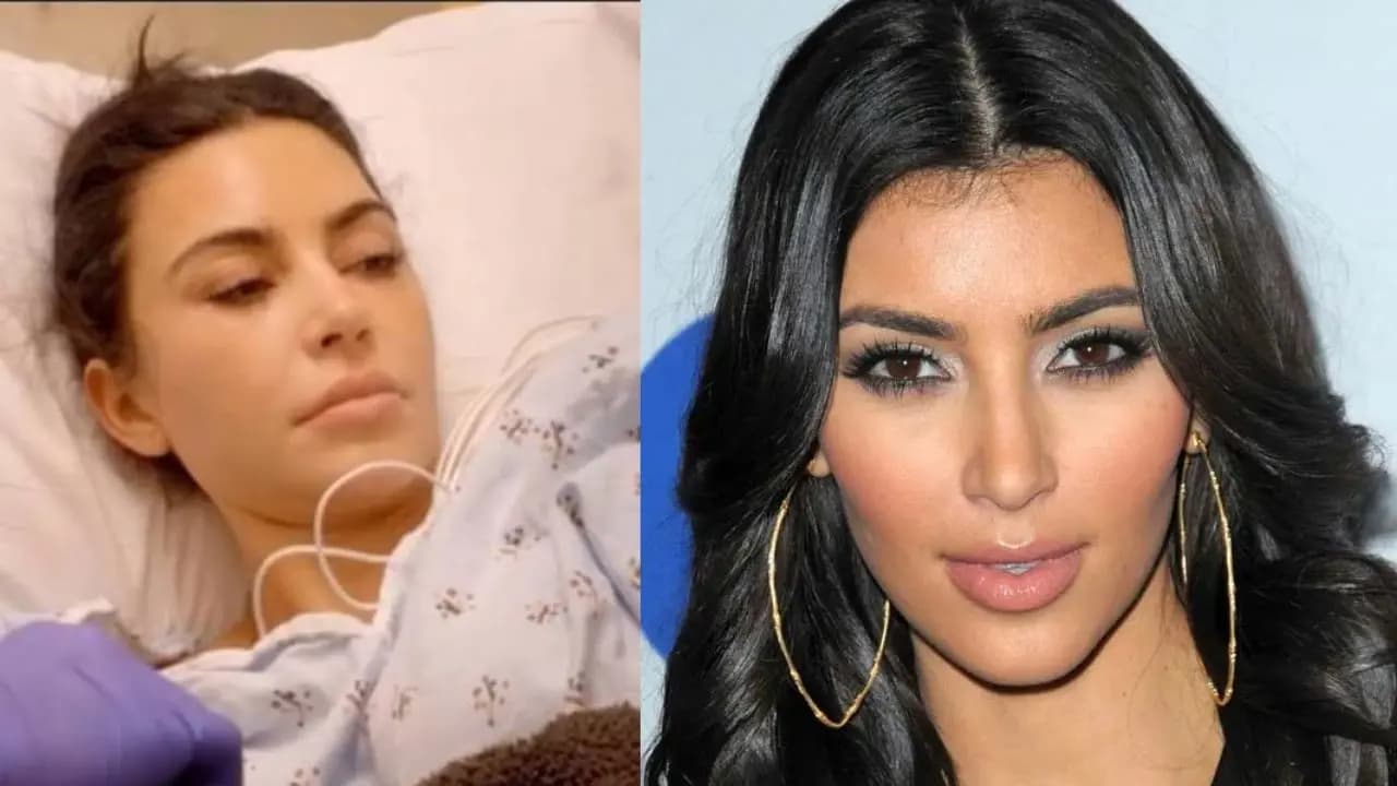 Kim Kardashian diagnosed with esophagitis know what is this medical condition why it happens and symptoms