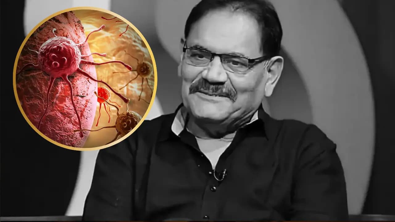 Cancer Relapse Reason: Mushtaq Khan passes away at just 56; what happens When cancer return after being cured?