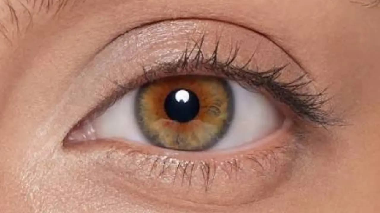 Heart attack High Cholesterol Eye Stroke symptoms can be seen right in the eyes Do not ignore these 5 signs