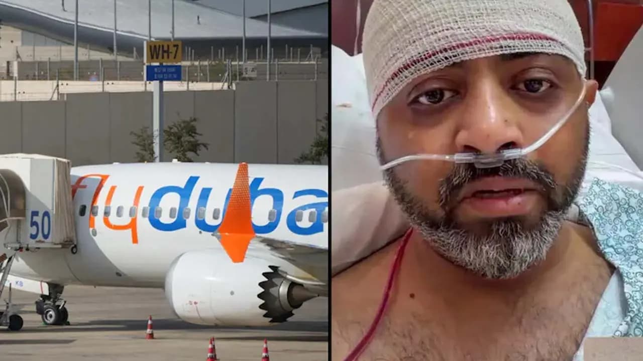Gruesome: Smith Machhar suffered a skull fracture after being struck by the co-pilot emergency measures were taken immediately upon landing in Saudi Arabia 