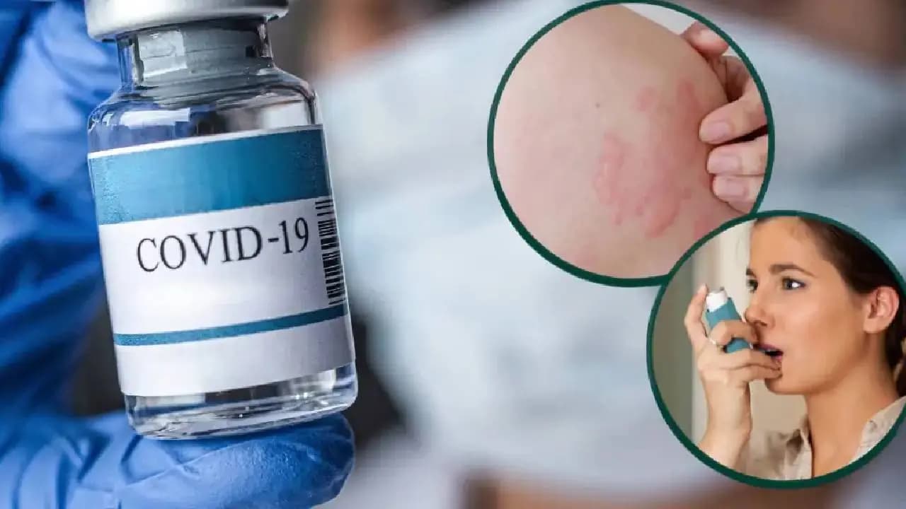 COVID-19 May Trigger New Allergies Finds Study
