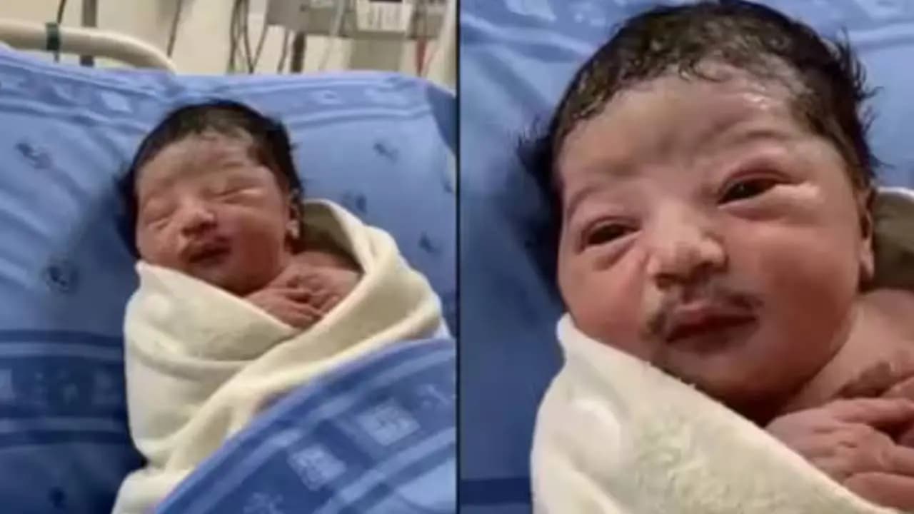 Truth Behind the Viral Newborn with a Grown-Up Moustache Exposed