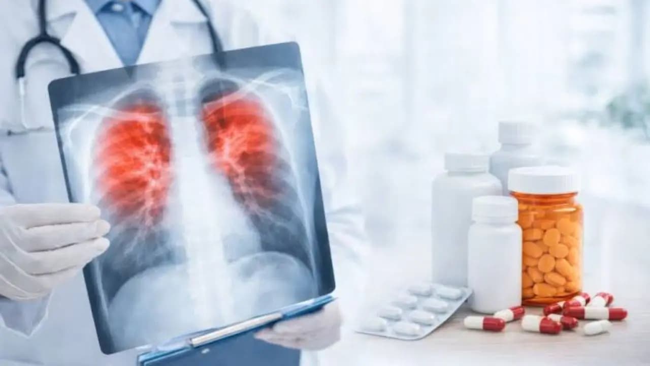 WHO New TB Treatment: WHO sets global targets for single shot tuberculosis prevention shorter treatment regimens