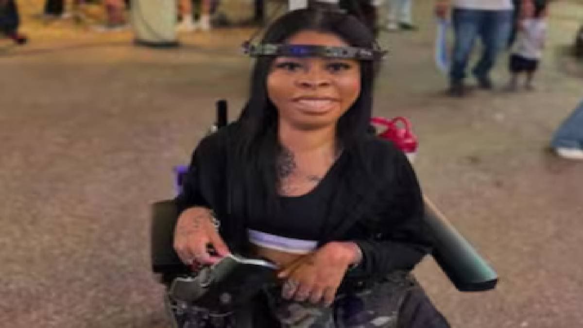 This Woman Has 15 Iron Screws In Her Head why