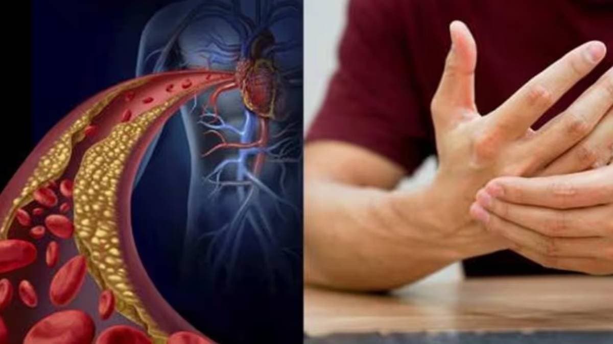 know these warning signs of increasing cholesterol in your body lif