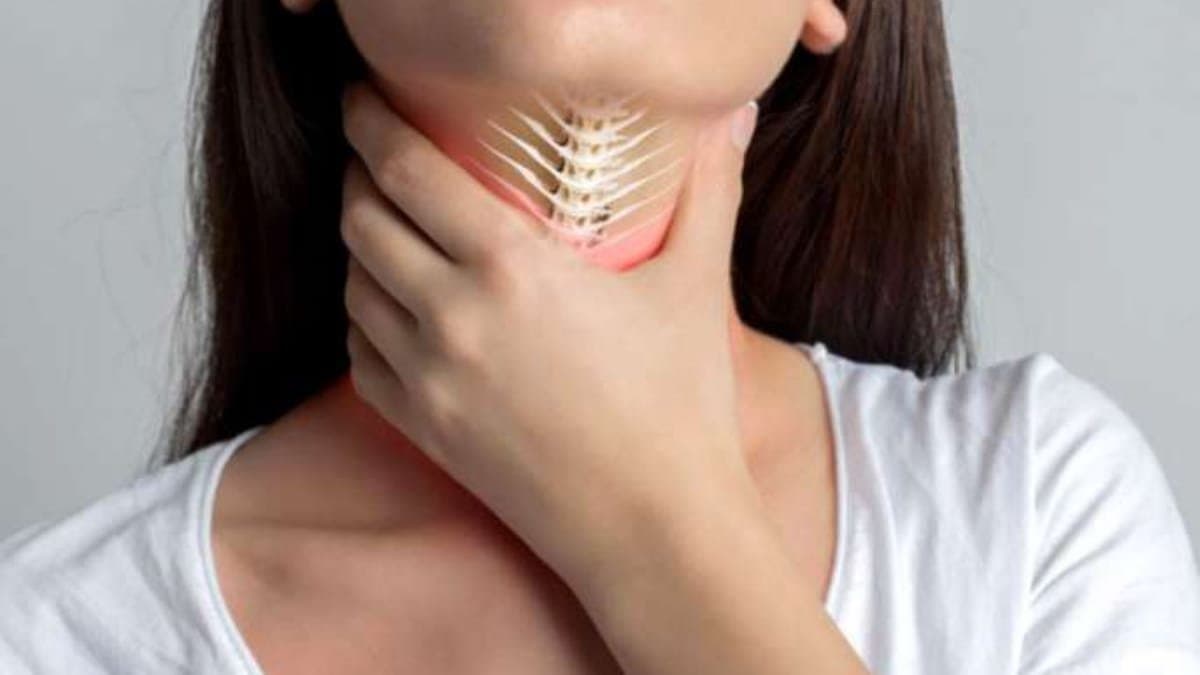 fish bone stuck in throat remedies lif