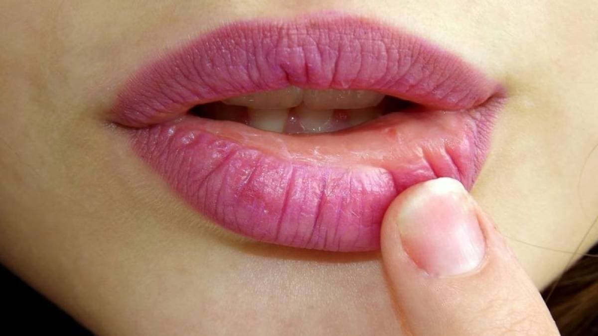 How to take care of your lips in winter season lif