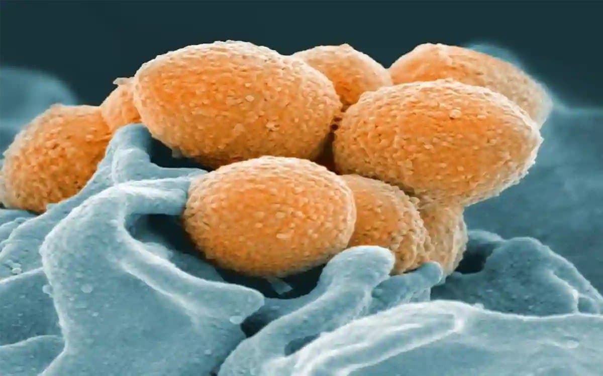 Rare flesh-eating bacteria spreads in Japan