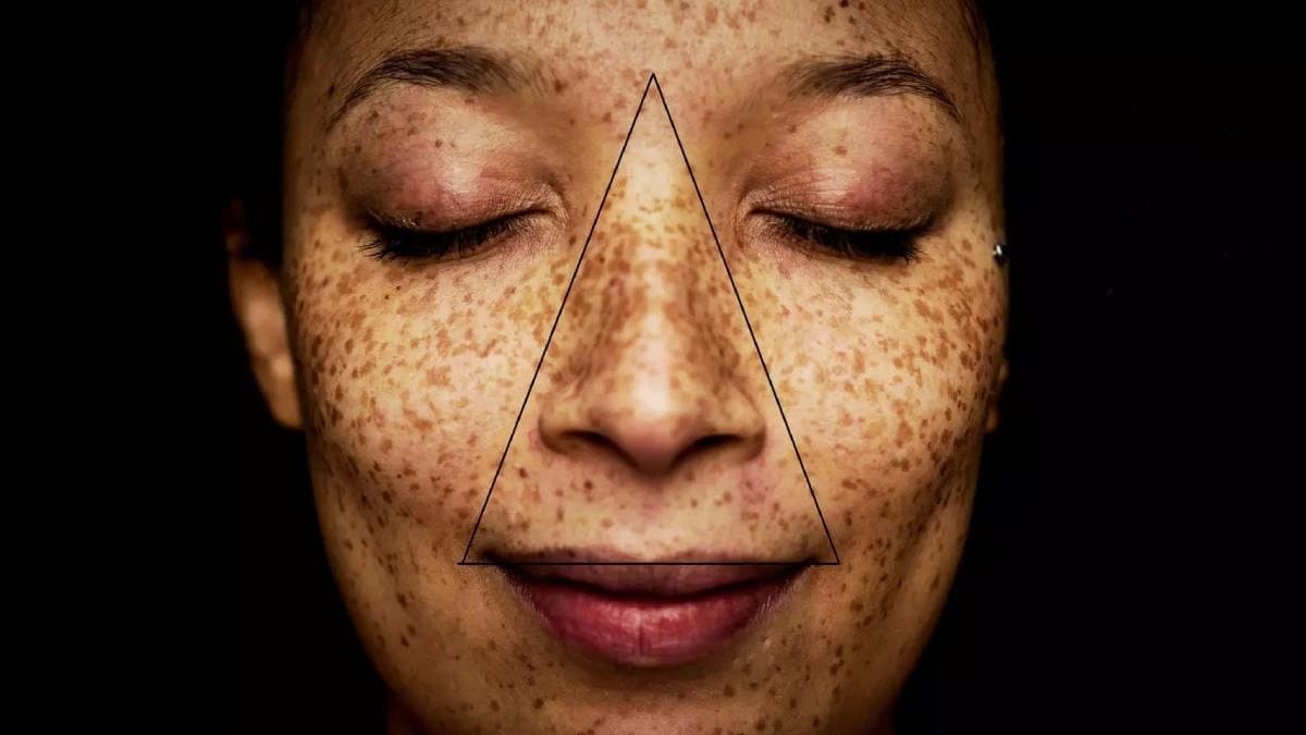 What is death triangle in face and why is it dangerous