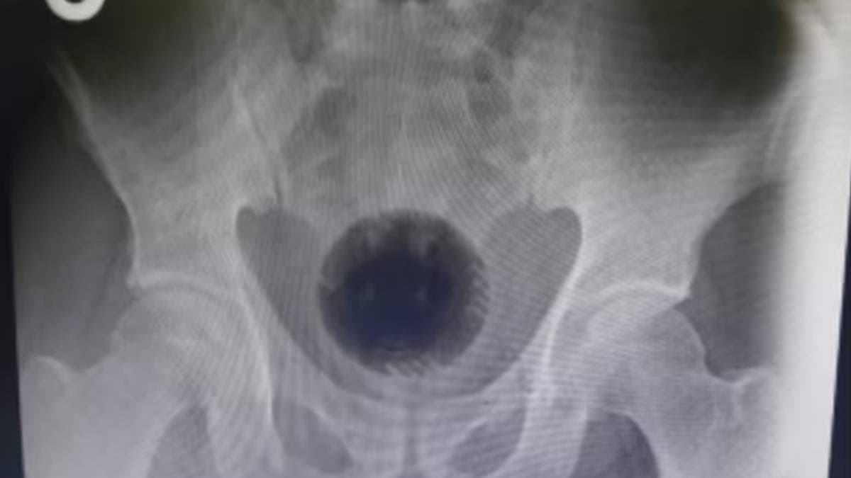 uluberia mill worker dies out of prank gnr