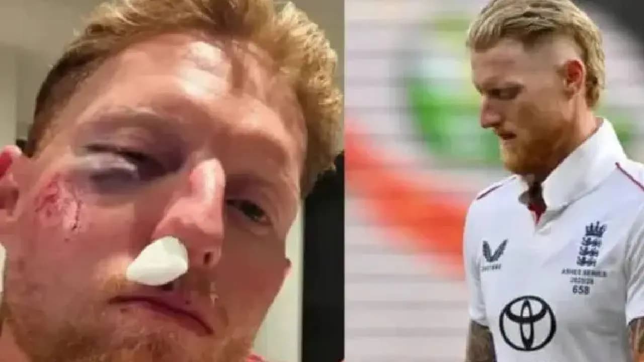 Ben Stokes injury