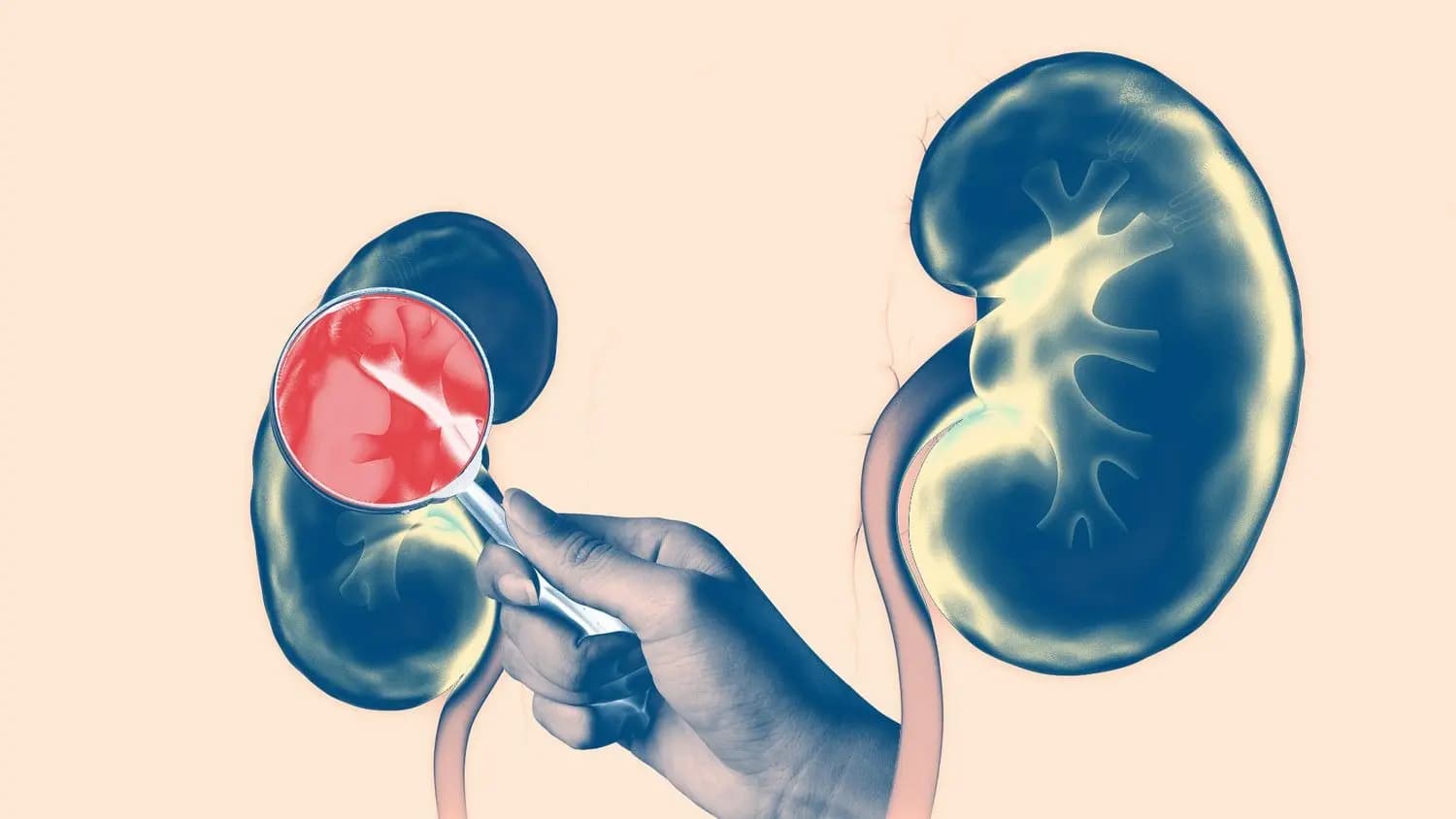 THESE foods may boost your kidney health