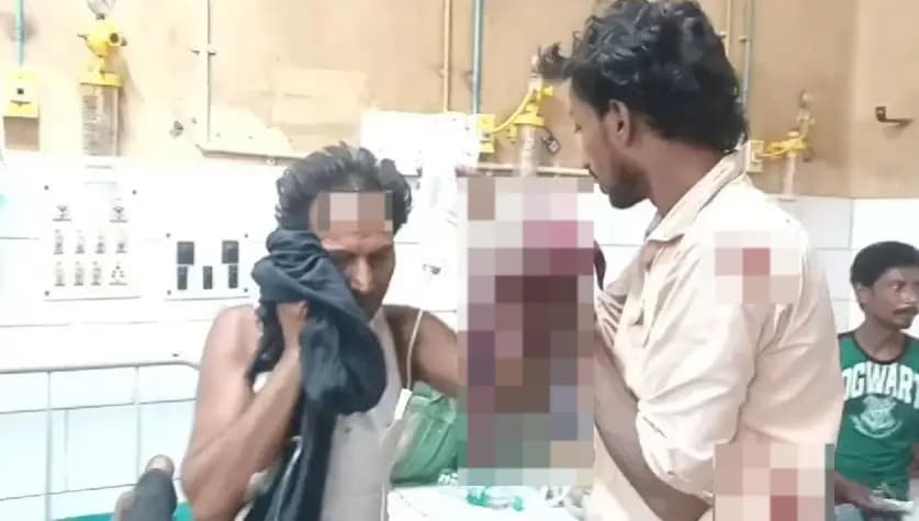 bomb injury in murshidabad