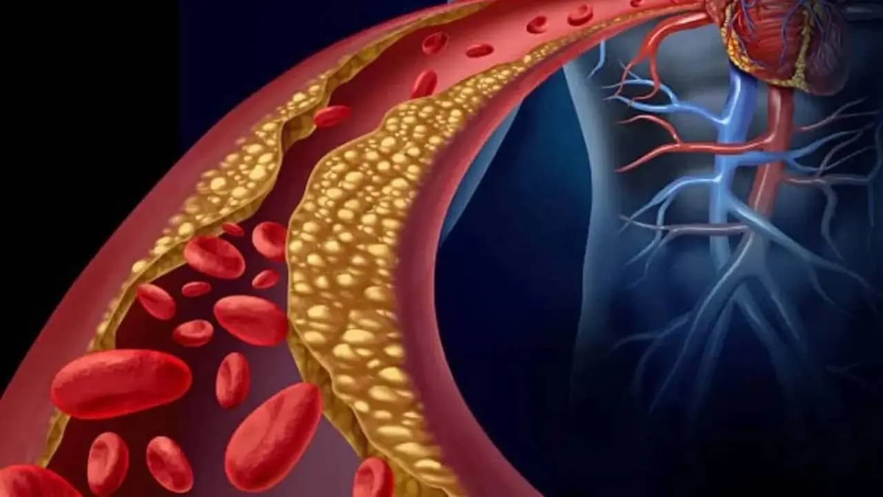 High Cholesterol Warning: Essential Signs and Management Tips for Young Adults in India