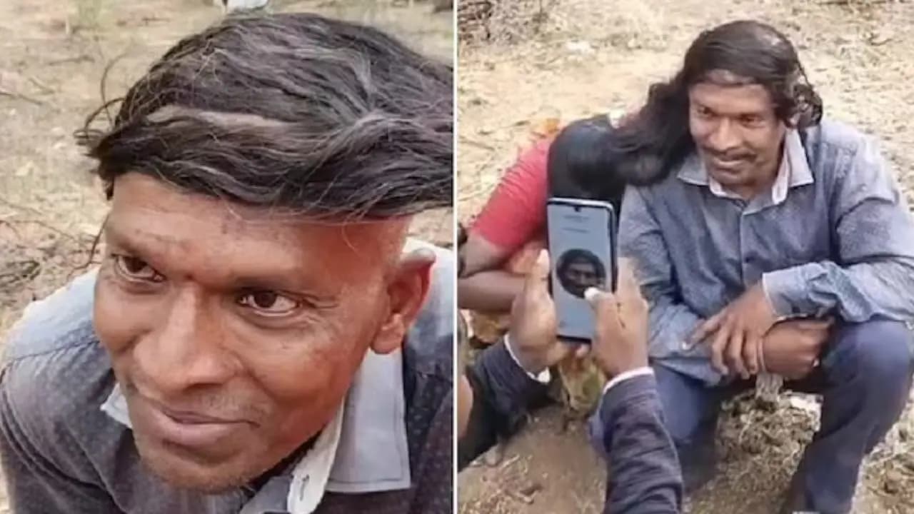 viral video of risking losing job due to baldness