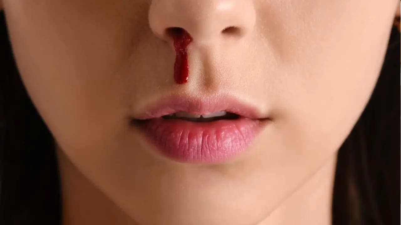 Frequent Nosebleeds Could Signal High Blood Pressure