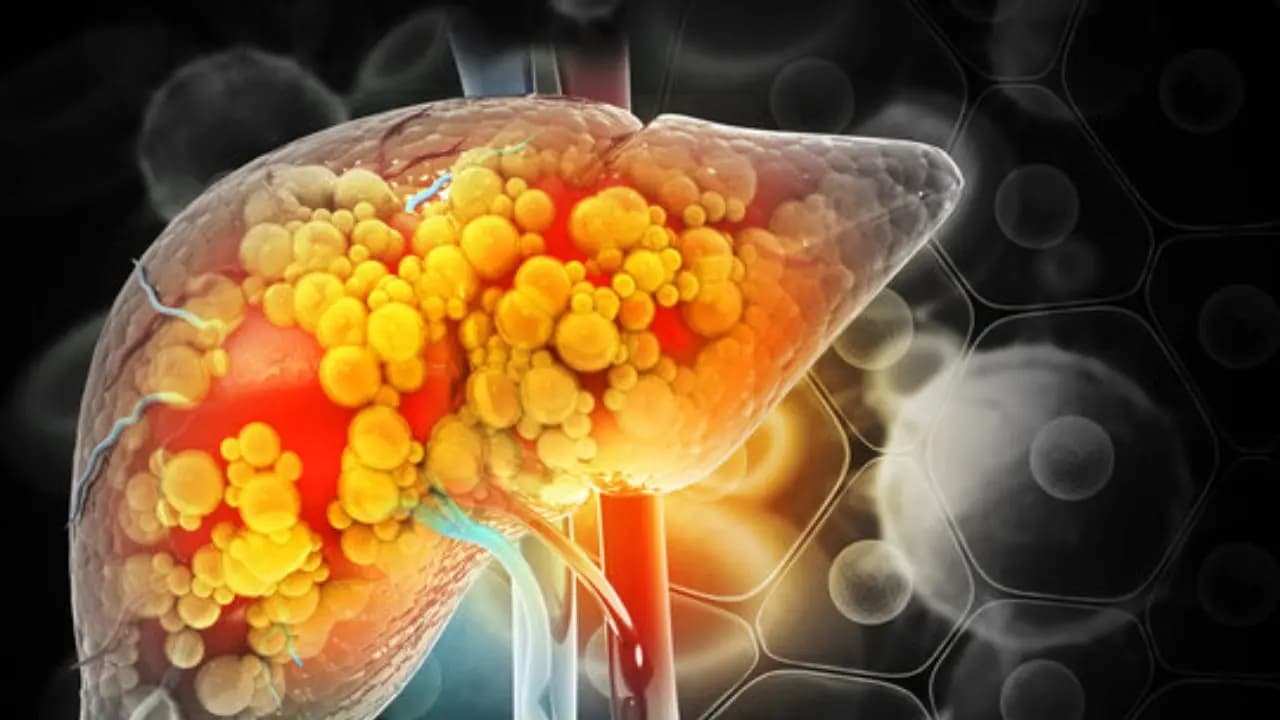 liver detox