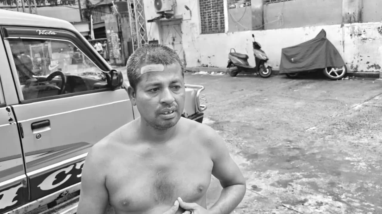 Baruipur Encounter: State Health Department decided to do digital x-ray before the postmortem