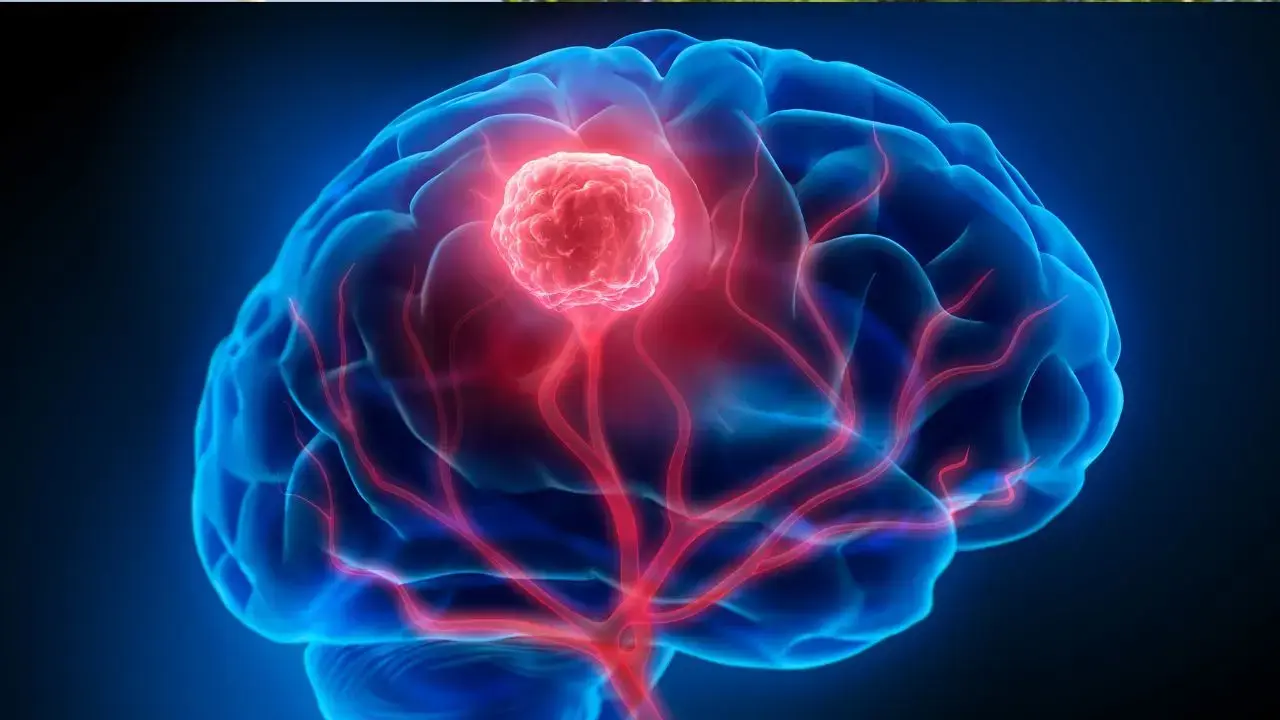 Contraceptive Increase Rare Brain Tumor Risk