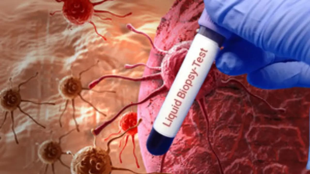Can biopsy make cancer spread faster here is what oncologists are saying