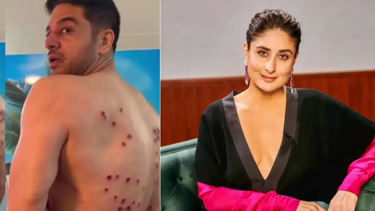 Gaurav Khanna's injury is severe; proud mother Kareena